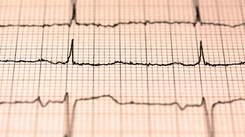 como frecuencia cardiaca reposo indica salud